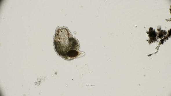 Flat Worm Turbellaria Similar To the Class Dunaliella Viridis, Under a Microscope alt