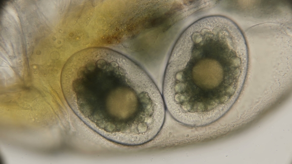 Daphnia Eggs Inside the Body, Under a Microscope alt