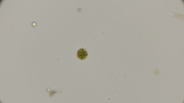 Acanthocystis, Heliozoa Under the Microscope alt