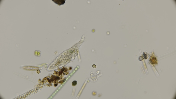 Ciliary Infusion of Uroleptus Under a Microscope alt