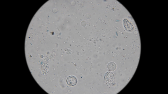 the Hemolymph of the So-called Blue Blood of a Crayfish Under a Microscope alt