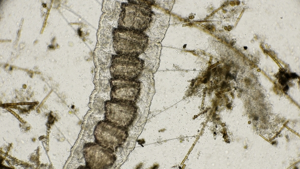 the Worm of the Family Naididae, Pristina Longiseta and the Reduction of Its Internal Organs Under a alt