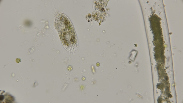 Infusoria Stylonychia Under the Microscope alt
