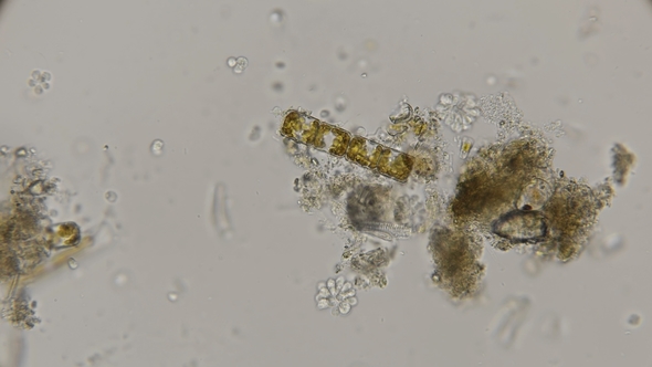 Synura Algae Causing Water To Bloom, Under a Microscope alt