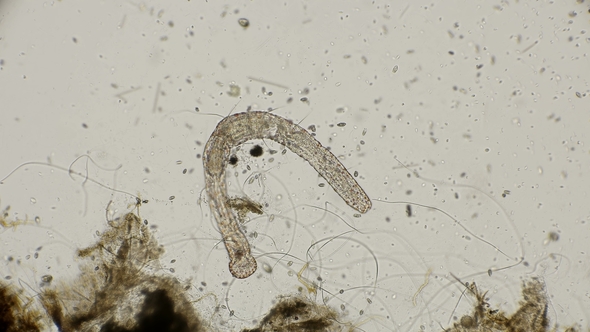 Worm of the Family Aeolosomatidae Aeolosoma Hemprichi Under the Microscope alt
