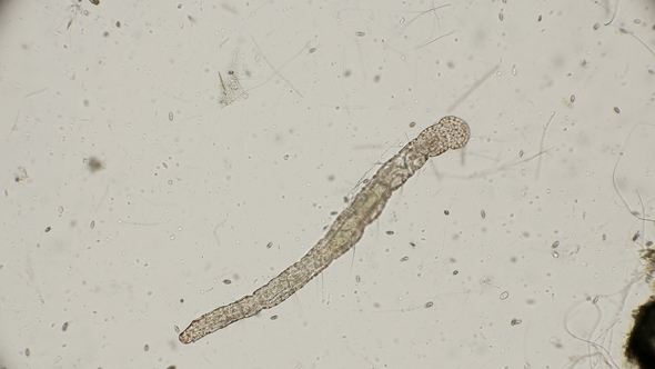 Worm of the Family Aeolosomatidae, Aeolosoma Hemprichi, Under the Microscope alt