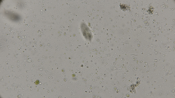 Microorganisms and Bacteria Living in Rotten and Rotten Water, Under a Microscope alt