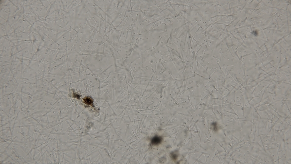 Colony of Spirochete, Rod-shaped Bacteria and Other Bacteria Living in Dirty, Rotten Water, Under a alt