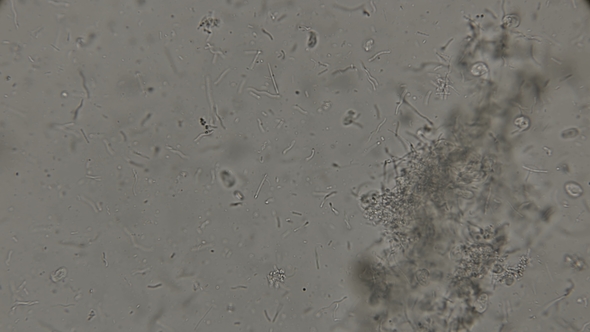 Drop of Dirty Water with Bacteria: Spirochaetes, Rod-shaped Bacteria, Bacilli and Others alt