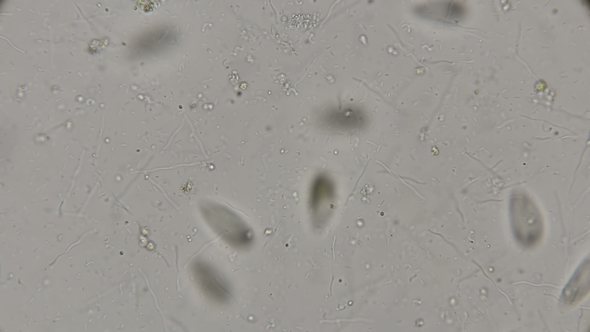 Microorganisms and Bacteria Living in Rotten and Rotten Water, Under a Microscope alt