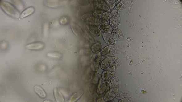 A Large Colony of Paramecium Putrinum Infusoria Inhabiting Waters with Oxygen Deficiency alt