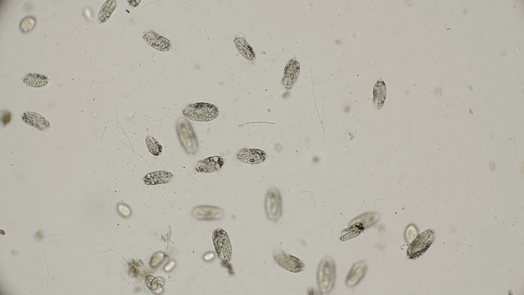 a Colony of Ciliates Stylonychia Under the Microscope alt