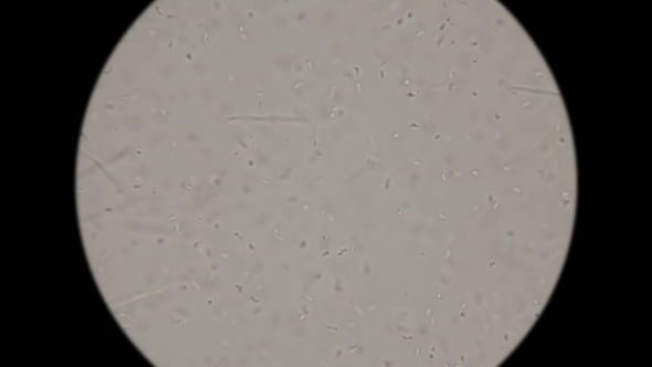 Colony of Bacteria Living in Dirty Rotten Water: Vibrio, Spirilla, Spirochaetes and Others alt