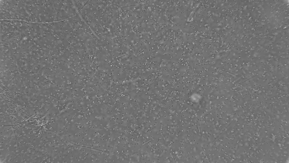 Microorganisms and Bacteria Living in Rotten and Rotten Water, Under a Microscope alt