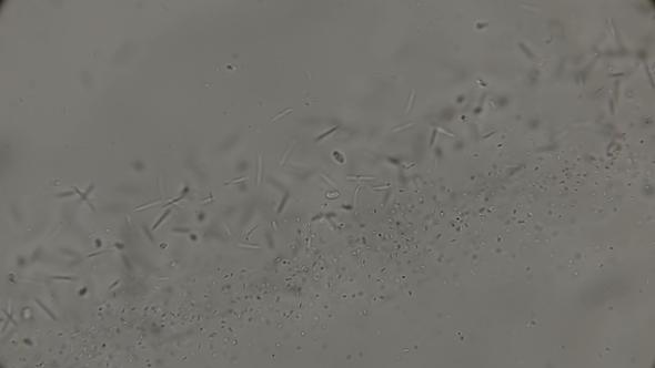 Colony of Bacteria Living in Dirty Rotten Water alt