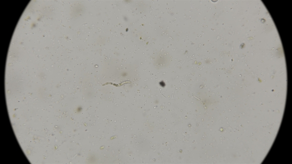 Spiral, Curved Bacterium, a Parasite ,Under the Microscope alt