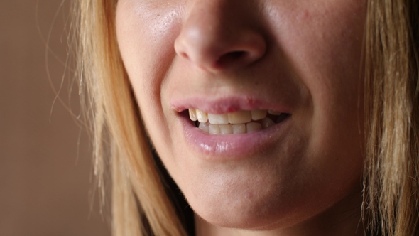 Beautiful Young Woman with Sores From Herpes on Her Lips. The Girl Is Sick of Laughing Because of