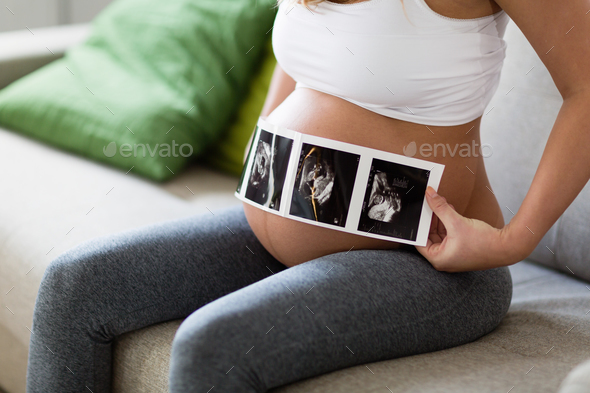 Pregnant woman holding ultrasound photo on belly Stock Photo by nd3000