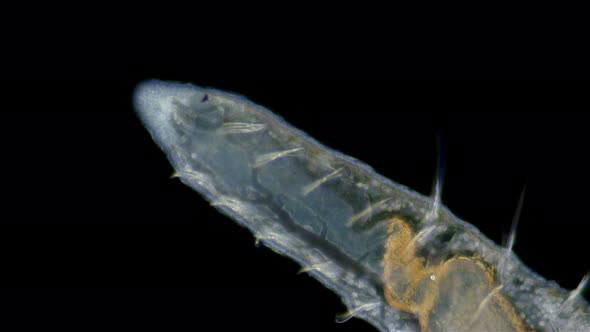 worm Nais sp. under a microscope, Family Naididae, a class of Oligochaeta alt