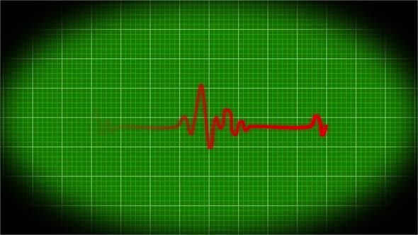 Health ECG Heart Beat Line Simulation animation. Vd 1965