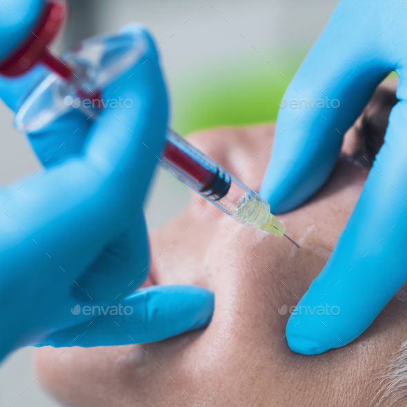 Hyaluronic Acid Injection. Cosmetic Anti-Aging Face Treatment - Stock Photo - Images