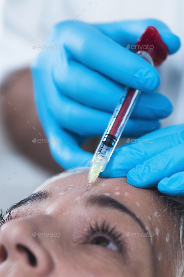Hyaluronic Acid Injection. Cosmetic Anti-Aging Face Treatment - Stock Photo - Images