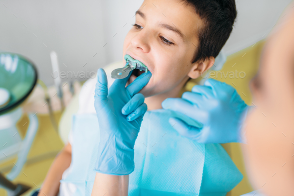 Female dentist makes teeth impression