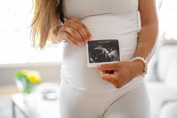 Close-up of pregnant woman holds ultrasound photo at her belly - Stock Photo - Images