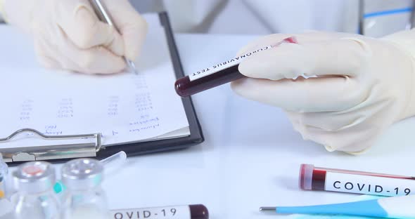 Analyst Hands Holding Coronavirus COVID 19 Test Blood 