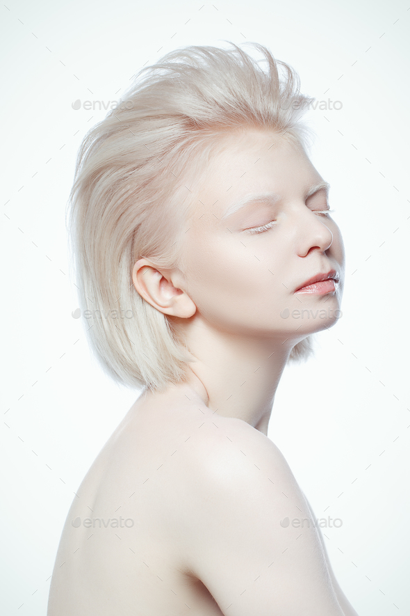 √99以上 Albino Girl 318581 Albino Girl Rapper