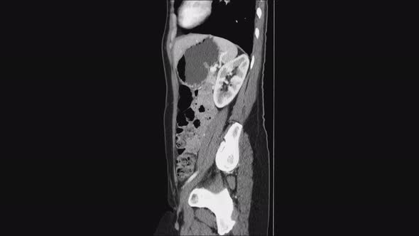 MRI of the Female Pelvic Organs, Abdominal Cavity, Gastrointestinal Tract and Bladder alt