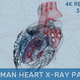 Human Heart X-Ray Pack - VideoHive Item for Sale
