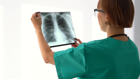Doctor Professional Radiologist Checking Analyzing Lung X Ray alt