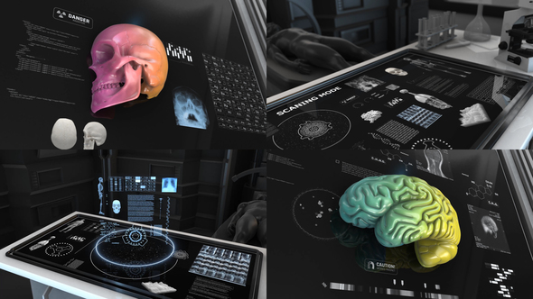 200- Anatomical Infographics - VideoHive 24063143