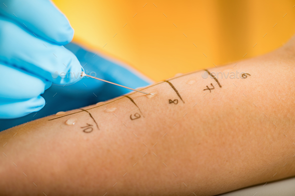 skin-prick-allergy-testing-stock-photo-by-microgen-photodune