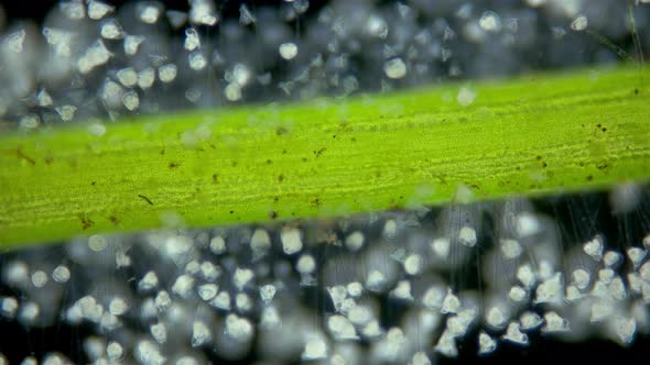Infusoria Ciliophora Vorticella Under Microscope Class Oligohymenophorea alt