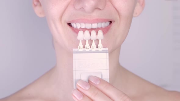Perfect White Teeth Close Up with Shade Guide Bleach Color Female Veneer Smile Dental Care and alt