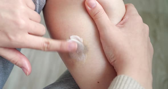Closeup of Hands Applying Balm to Leg alt