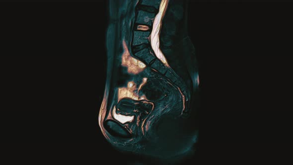 Bulk Multicolored MRI of the Female Pelvic Organs, Abdominal Cavity, Gastrointestinal Tract and