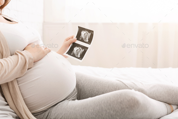 Pregnant woman holding ultrasound photo of baby and caressing her belly
