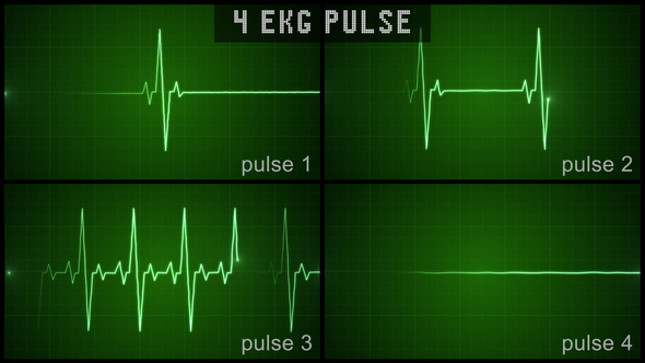 EKG Pulse Set