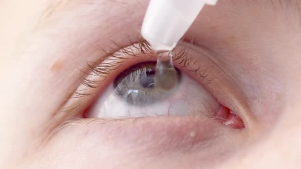 Closeup Young Man Drops Eye Drops Install Lenses Moisturizing Using Medical Eyes Drops Suffering alt