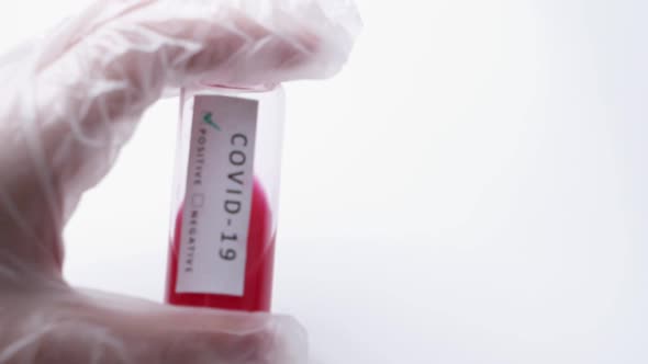 The Doctor Holds a Test Tube with Blood, Testing for Infection with a New Coronovirus alt