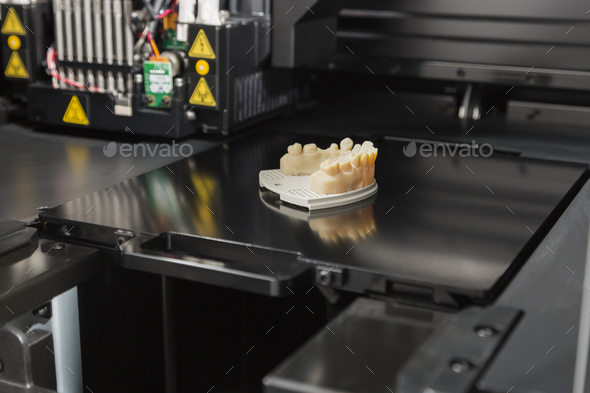3D Printer With Finished 3D Printed Dental Implant Bridge