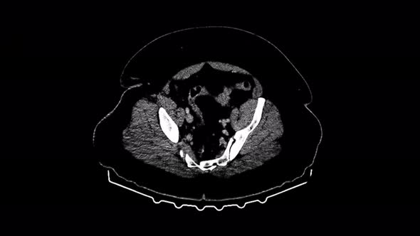 Visualization and Analysis of MRI Scans By a Radiologist on a Computer Screen alt