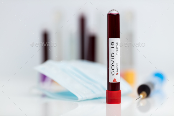 Laboratory sample of the novel Coronavirus
