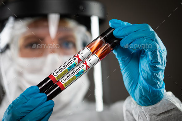 Female Doctor or Nurse Holding Test Tubes of Blood Labeled Positive for Coronavirus COVID-19 Disease