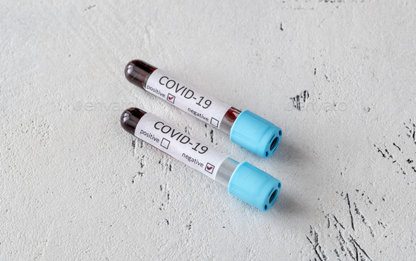 Coronavirus testing - Stock Photo - Images