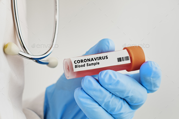 coronavirus testing - Stock Photo - Images