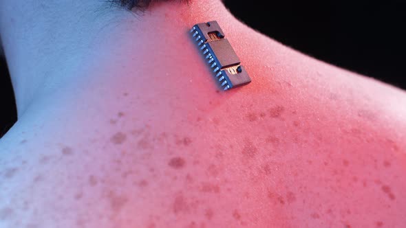 Implanted Chip on the Back of a Man alt